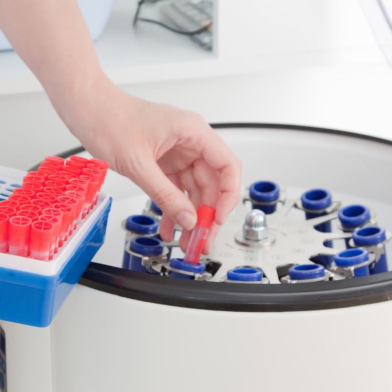 Centrifugadora_sangre_clínica_médica_analista_laboratorio